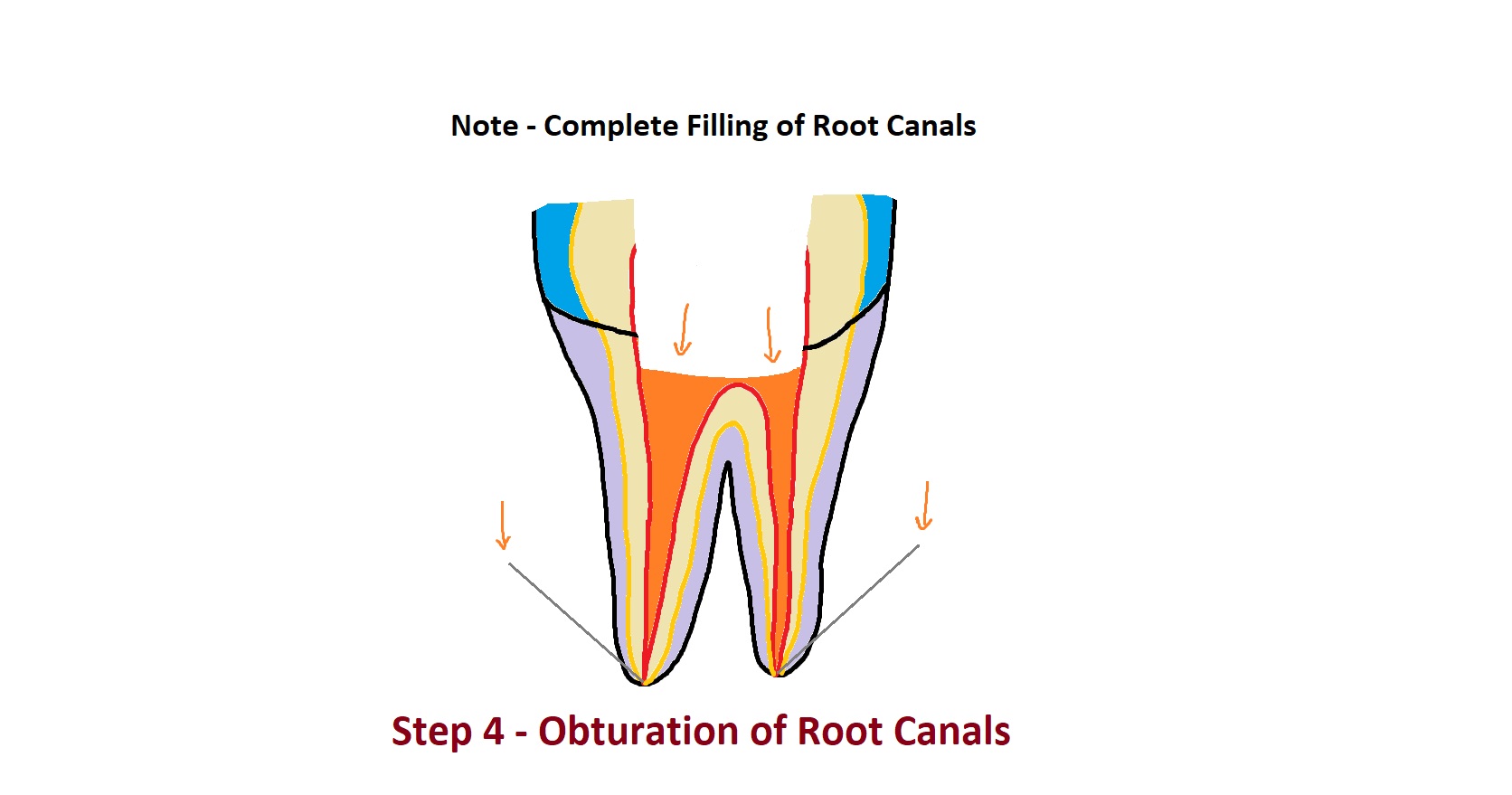 Why Dental Caries ? know simple answers.